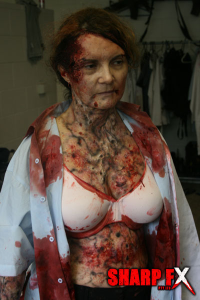 Prosthetic Makeup - Infected special Makeup effects